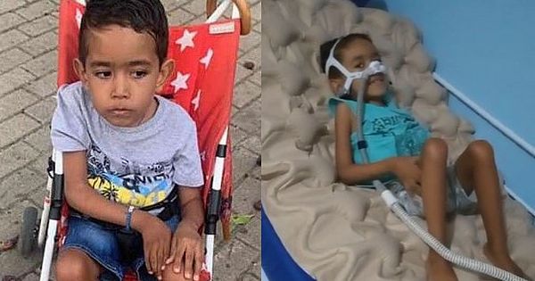 Família de menino com atrofia muscular consegue suporte ventilatório após campanha de doação em AL